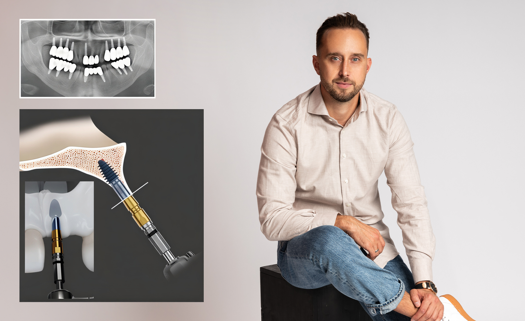 Lithuanian Surgeon Pioneers Next-Gen Dental Implant Tech in Europe
